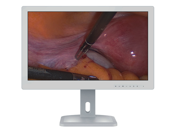 全高清内窥手术医用显示器